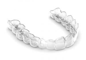 clear invisalign aligners