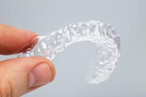clear aligners in omaha