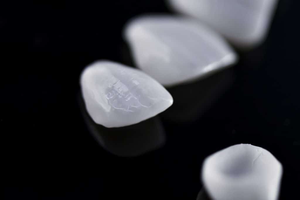 Omaha Dentist Improves Smile Beauty With Veneers Omaha, NE