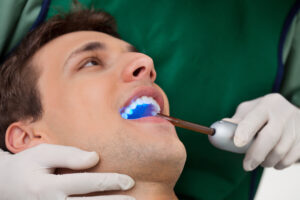 omaha dental fillings