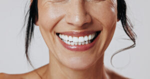 omaha teeth whitening 